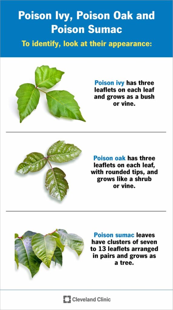 poison-ivy-l-ve-poison-oak-poison-sumac-s-mptomid-p-hjused-ja-ravi