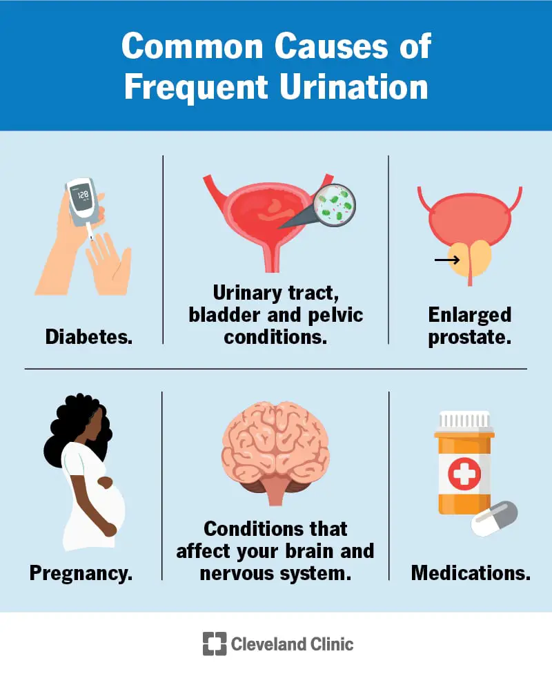 15533 frequent urination