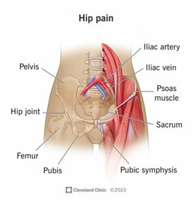 21118 hip pain