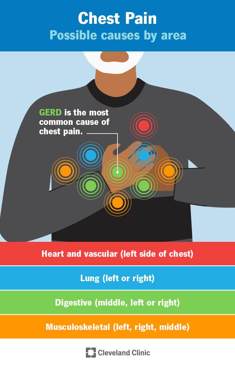 chest-pain-causes