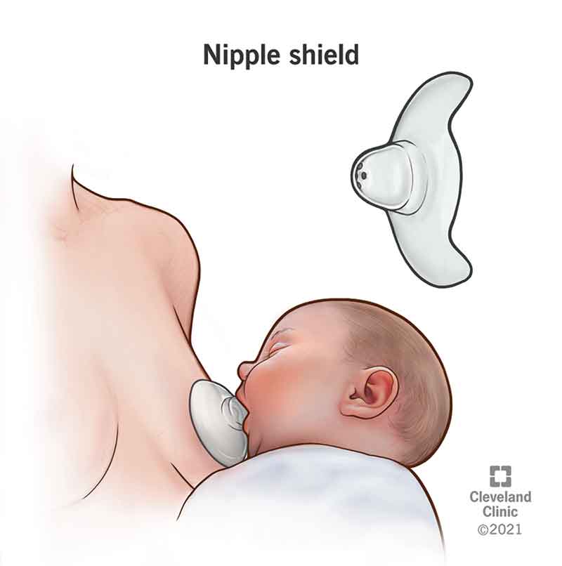 22130 nipple shield