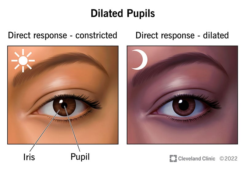 22238 dilated pupils