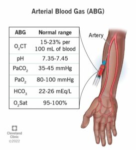 22409 arterial blood gas