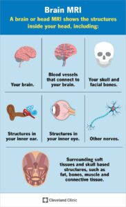 22966 brain mri