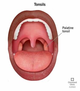 23459 tonsils illustration