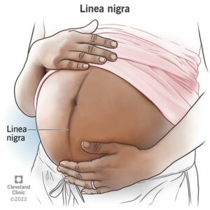 23488 linea nigra