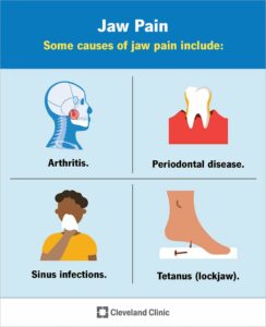 24447 jaw pain