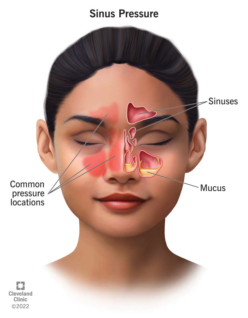 24690 sinus pressure