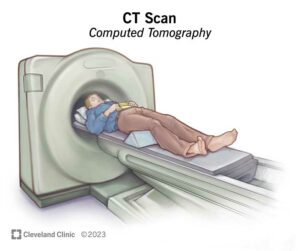 4808 ct computed tomography scan