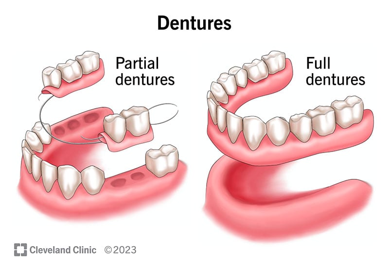 10900 dentures