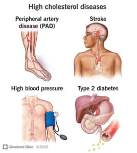 11918 high cholesterol diseases