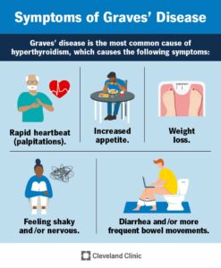 15244 graves disease