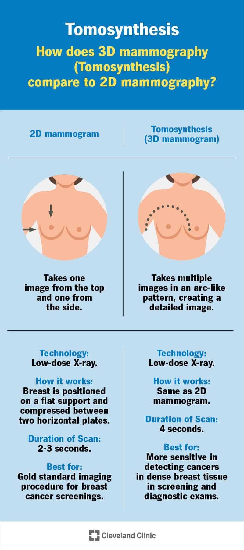 2D mammograafia ja tomosünteesi võrdlus
