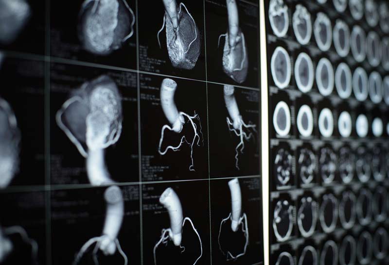 16834 heart ct scan