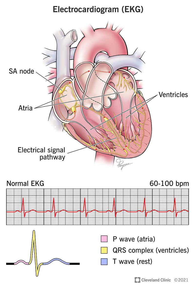 Illustratsioon sellest, kuidas EKG jälgib südame elektrilist aktiivsust.