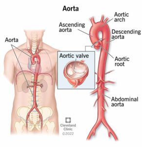 17058 aorta anatomy