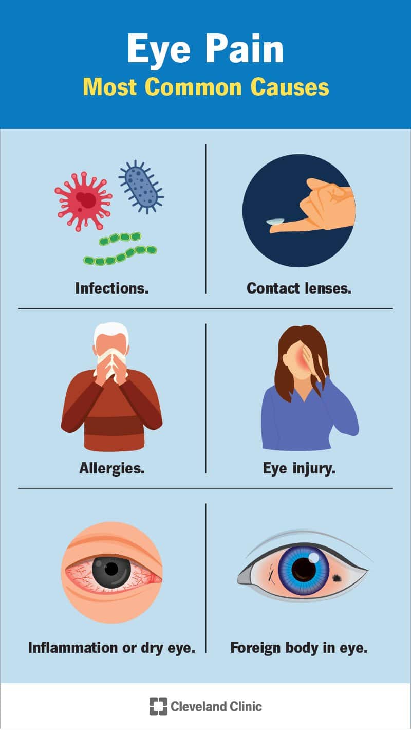 what-causes-pain-behind-the-eye-iristech