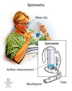 17833 spirometry