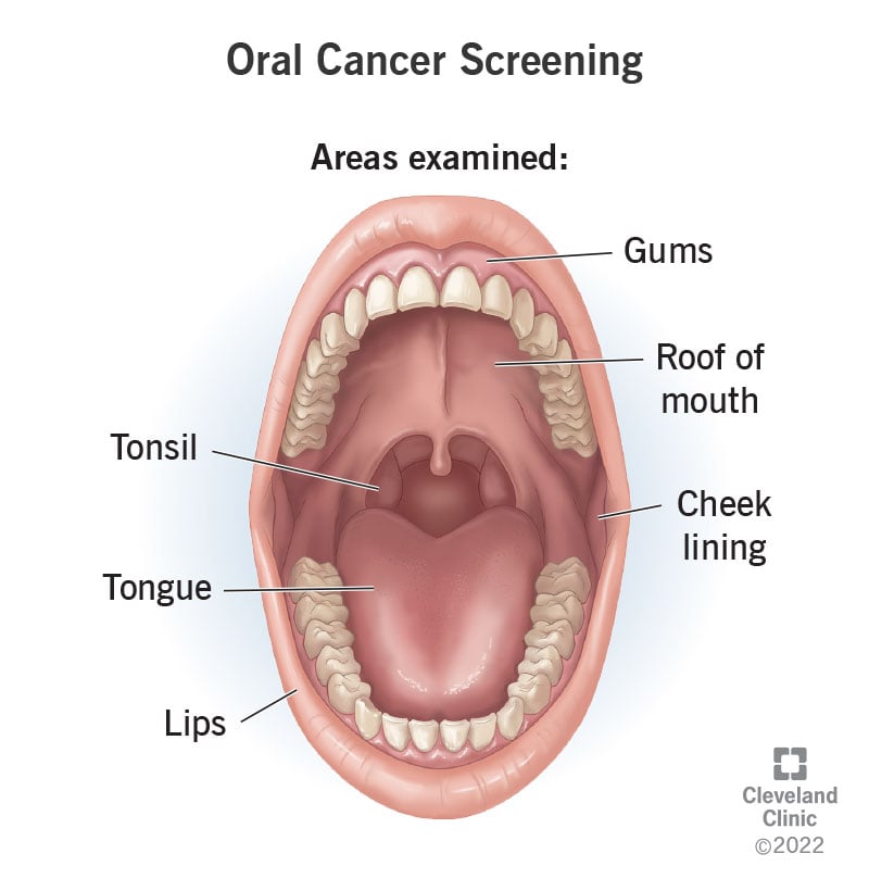 21056 oral cancer screening