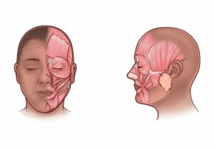 21672 facial muscles