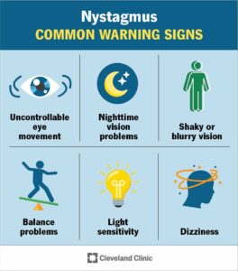 22064 nystagmus infographic