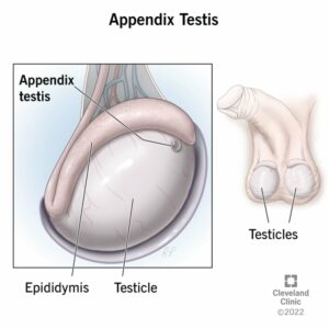 22507 appendix testis
