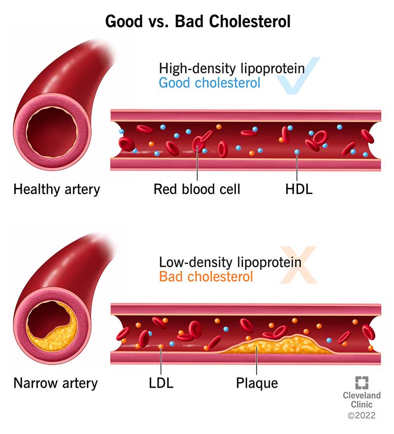 23922 what is cholesterol