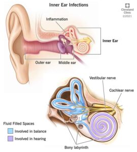 24240 inner ear infections