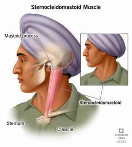 24939 sternocleidomastoid