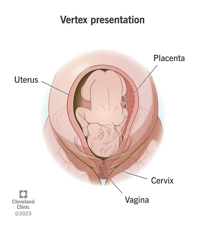 24999 vertex presentation