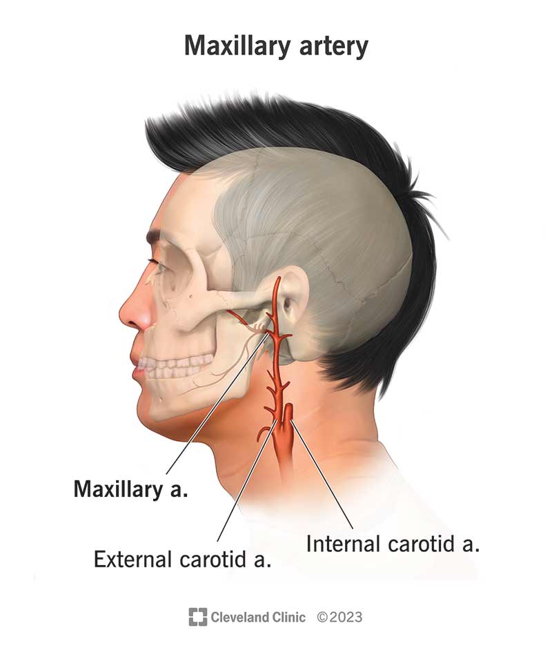 25031 maxillary artery
