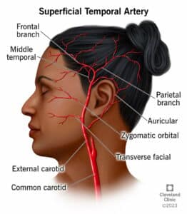 25042 superficial temporal artery illustration