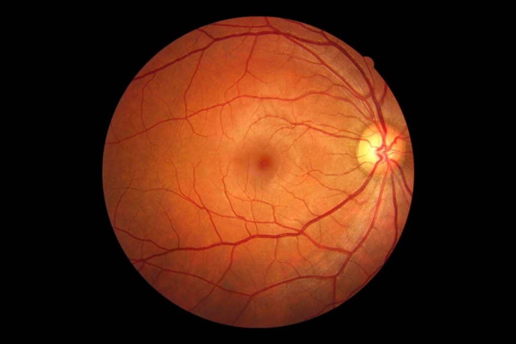 25046 retinal imaging