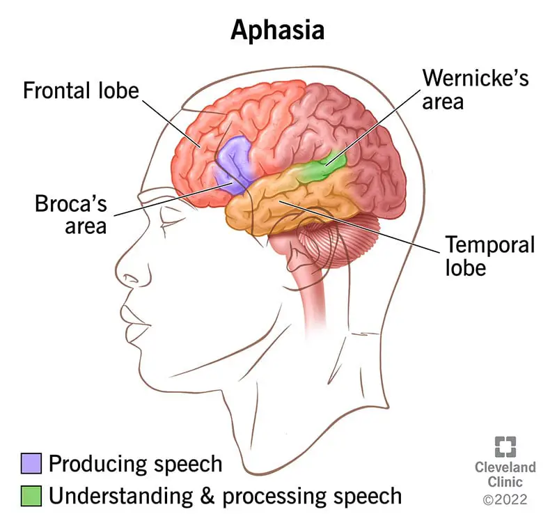 5502 aphasia