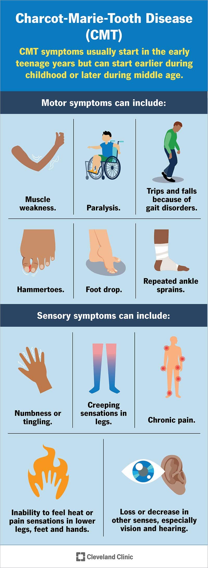 Charcot-Marie-Toothi ​​haiguse sümptomid mõjutavad tavaliselt liikumist ja meeli, eriti puudutust, nägemist ja kuulmist.  Paigutus: joonda ülaosas oleva ülevaatega.