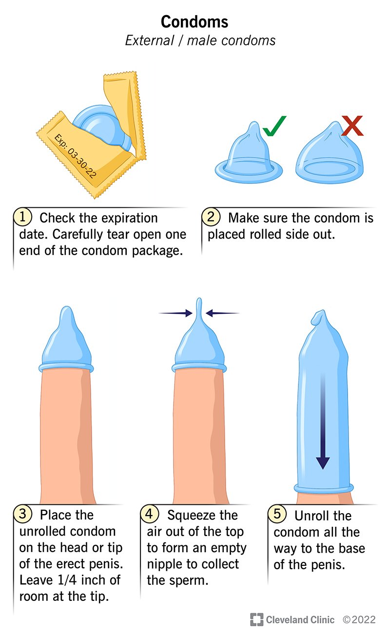 Samm-sammuline juhend kondoomi selga panemiseks.