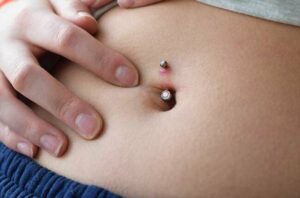 Infected Belly Button Piercing 1443971731 770x533 1 650x428