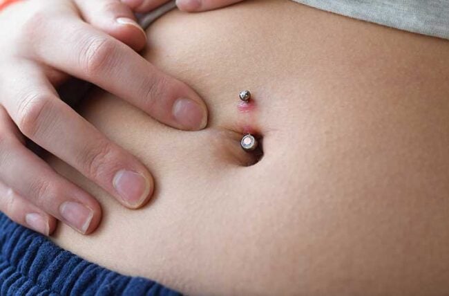 Infected Belly Button Piercing 1443971731 770x533 1