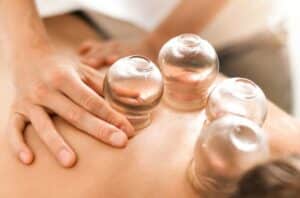 cuppingTherapy 1246919695 770x533 1 650x428