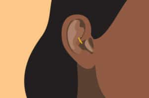 ear stapling1 1310664640 770x533 1 650x428