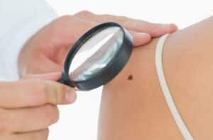 skin cancer check doc office 494372287 770x533 1 650x428