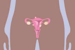 uterine Fibroid Tumors 1428226251 770x533 1 650x428