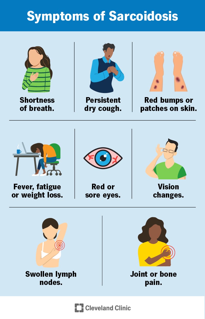 Sarkoidoosi sümptomiteks on õhupuudus, kuiv köha, punased punnid, palavik, väsimus, kaalulangus, punased või valulikud silmad ja palju muud.