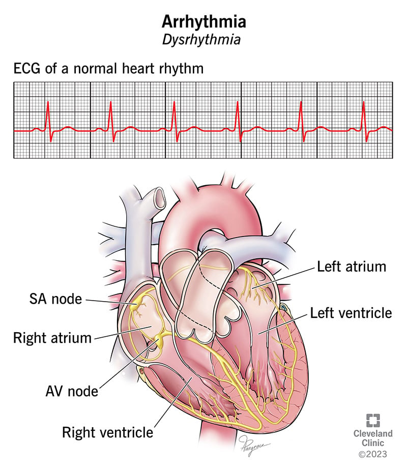 Juhtimissüsteem, mis käsitleb südamelöögisignaale.  ilma probleemideta loob normaalse EKG ilma arütmiata.