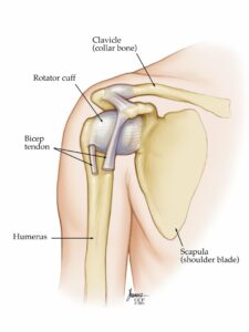 17746 dislocated shoulder