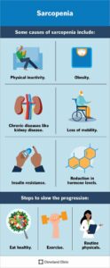 23167 sarcopenia infographic