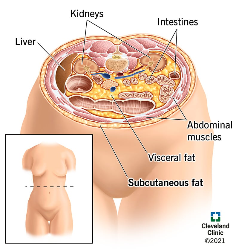 23968 subcutaneous fat