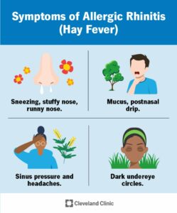 8622 allergic rhinitis hay fever