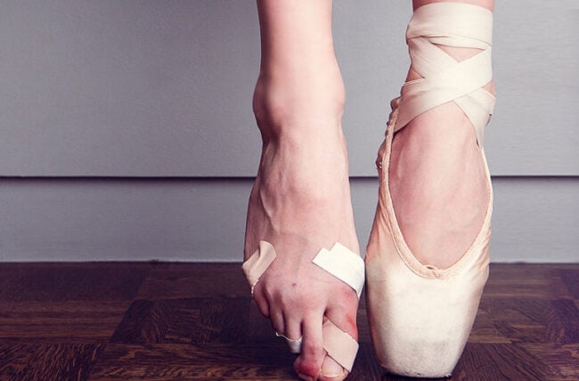 ballerina feet bruises bandaids 177683142 770x533 1