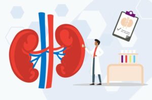 kidney Disease Diagnosis 1187631490 770x533 1 650x428